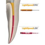 LightSpeed LSX sorozat  ISO 020-080 21-25-31mm (12db)