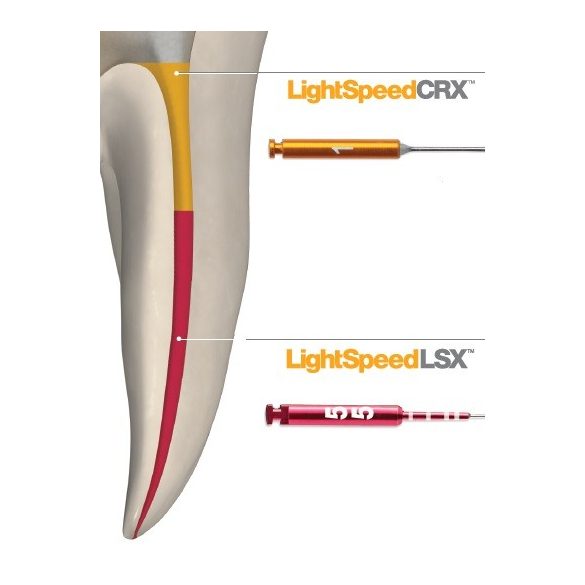 LightSpeed LSX sorozat  ISO 020-080 21-25-31mm (12db)